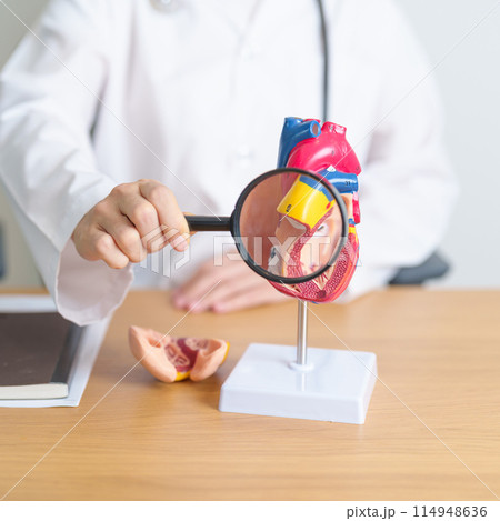 Doctor with human Heart anatomy model and magnifying glass. Cardiovascular Diseases, Atherosclerosis, Hypertensive Heart, Valvular Heart, Aortopulmonary window, world Heart day and health concept 114948636