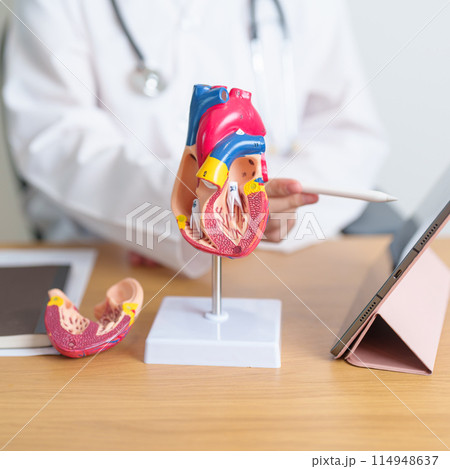 Doctor with human Heart anatomy model and tablet. Cardiovascular Diseases, Atherosclerosis, Hypertensive Heart, Valvular Heart, Aortopulmonary window, world Heart day and health concept 114948637