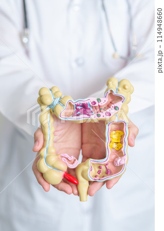 Doctor holding human Colon anatomy model. Colonic disease, Large Intestine, Colorectal cancer, Ulcerative colitis, Diverticulitis, Irritable bowel syndrome, Digestive system and Health concept Doctor holding human Colon anatomy model. Colonic disease, Large Intestine, Colorectal cancer, Ulcerative colitis, Diverticulitis, Irritable bowel syndrome, Digestive system and Health concept 114948660