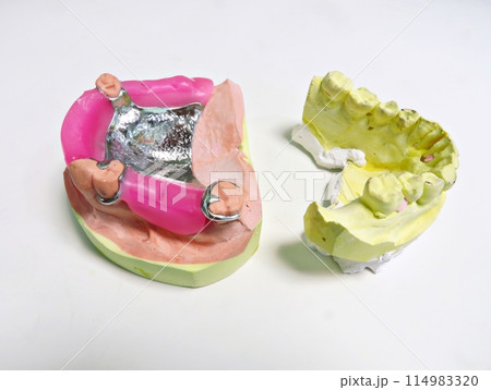 RPD Wax rim and metal frame RPD Wax rim and metal frame 114983320