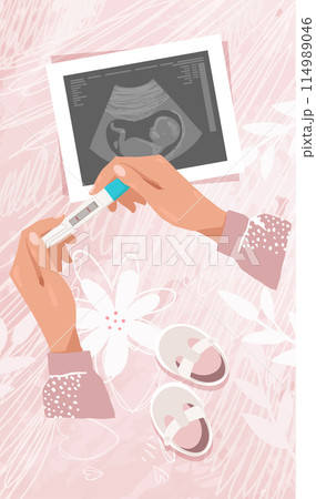 Maternity and pregnancy card, woman holding positive pregnancy test, modern collage, vector illustration. 114989046