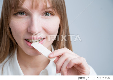 Young woman with metal braces on her teeth is chewing gum. Copy space.  114996590