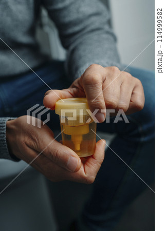 man closes a sterile container with a urine sample 114999582