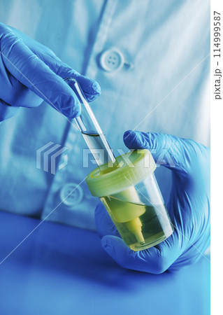 laboratory worker filling a tube with a urine sample 114999587