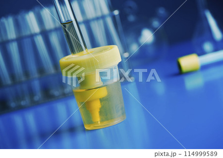 container with a sample of urine in the laboratory 114999589