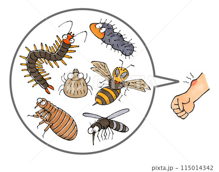 虫に刺された腕 115014342