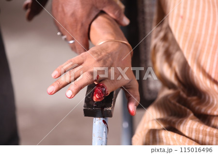 Male hand with Blood 115016496