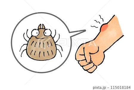 ダニに噛まれた腕 ダニに噛まれた腕 115018184