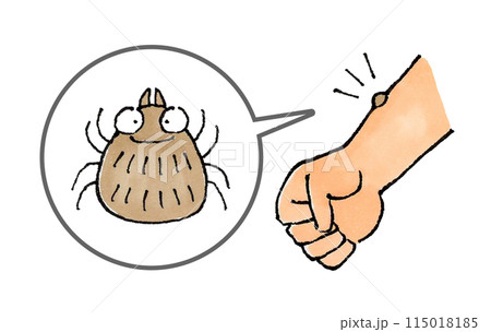 ダニに噛まれた腕(吸着) 115018185