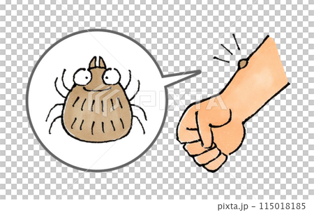 ダニに噛まれた腕(吸着) 115018185