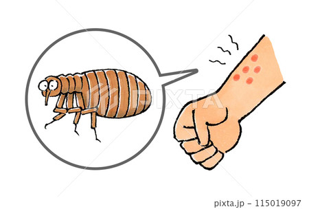 ノミに噛まれた腕 ノミに噛まれた腕 115019097