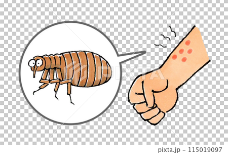 ノミに噛まれた腕 ノミに噛まれた腕 115019097