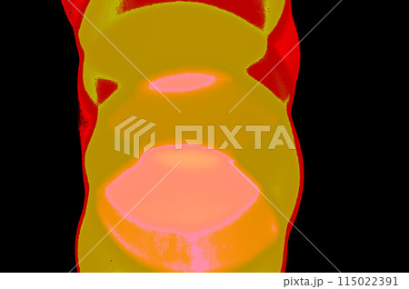 3D rendering of a human body with highlighted red and yellow skin. Abstract background 115022391