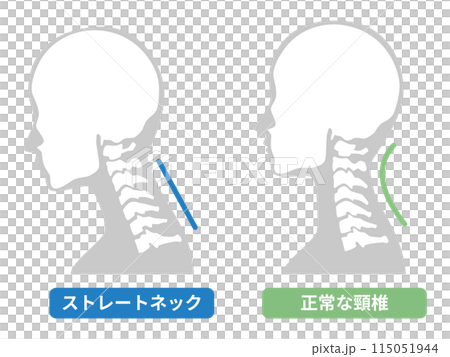 2024-ストレートネックイラスト 115051944