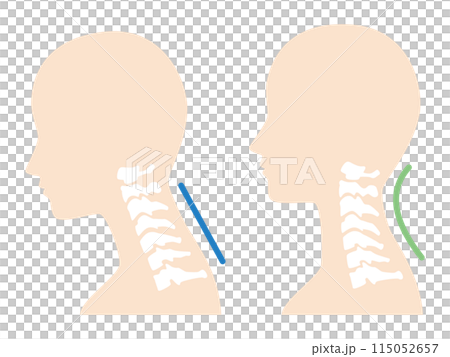 2024-ストレートネックイラスト 115052657