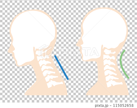 2024-Straight neck illustration 2024-Straight neck illustration 115052658