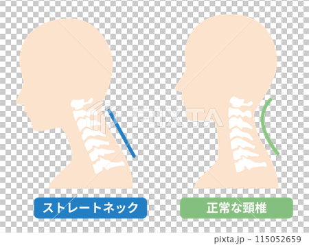 2024-Straight neck illustration 115052659