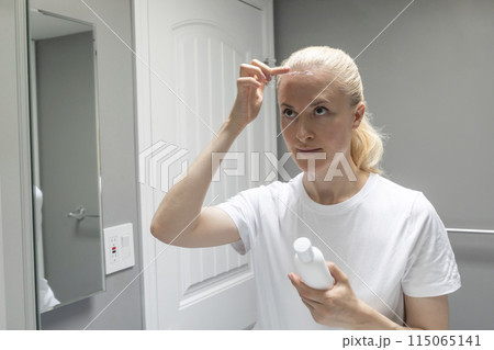 Female Applies Moisturizer, Cream on Sunburn Skin On Scalp, Forehead Under Hair in Bathroom. White Woman Suffers From Sun Burn, Holding White Tube, Bottle of Remedy. Horizontal. UV Danger 115065141