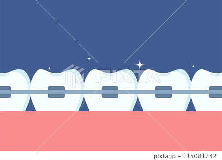 Row of teeth with braces on them. Orthodontics and aesthetic dentistry medicine. Molars with braces. Dentistry, whitening, orthodontics. Vector. 115081232