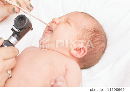 Doctor Examining Newborns Mouth 115086634