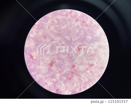 Moderate gram negtive bacilli in hemoculture. Moderate gram negtive bacilli in hemoculture. 115101557
