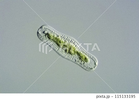 珪藻 ツメワカレケイソウ 珪藻 ツメワカレケイソウ 115133195