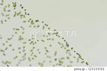 緑藻　テトラスポラ 115133332