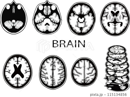 脳画像イラスト 115134856
