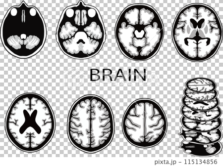 脳画像イラスト 115134856