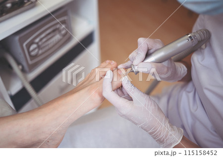Hardware medical pedicure with nail file drill apparatus. Patient on pedicure treatment with pediatrician chiropodist. Foot peeling treatment at spa with a special device. Clinic of Podiatry Podology 115158452