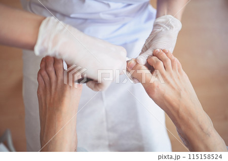 Professional medical pedicure procedure close up using nail clippers instrument. Patient visiting chiropodist podiatrist. Foot treatment in SPA salon. Podiatry clinic. Pedicurist hands in gloves 115158524