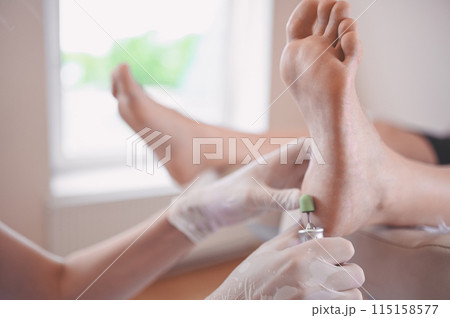 Podiatrist using grinding equipment and making procedure polish for feet pedicure. Podology beautician in white gloves cleaning skin of client legs from callus and corn with professional tool. Podiatrist using grinding equipment and making procedure polish for feet pedicure. Podology beautician in white gloves cleaning skin of client legs from callus and corn with professional tool. 115158577
