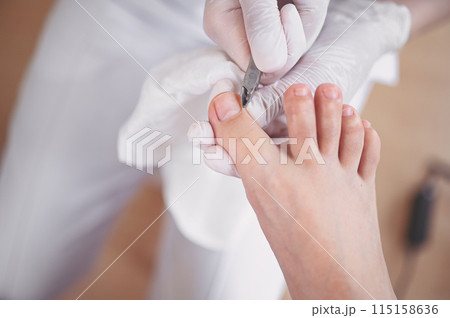 Professional medical pedicure procedure close up using nail clippers instrument. Patient visiting chiropodist podiatrist. Foot treatment in SPA salon. Podiatry clinic. Pedicurist hands white gloves. 115158636