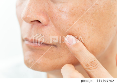 ミドル男性 ほうれい線 アップ ミドル男性 ほうれい線 アップ 115195702