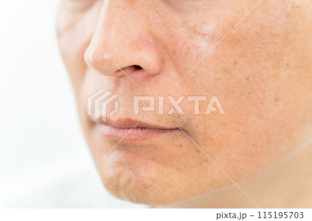 ミドル男性　ほうれい線　アップ 115195703