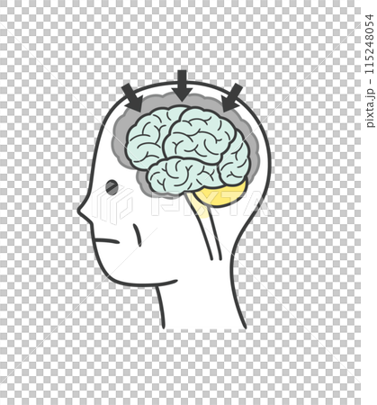 アルツハイマー型認知症によって損傷を受ける脳の部分のイラストのセット 115248054