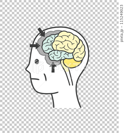 前頭側頭型認知症によって損傷を受ける脳の部分のイラスト 115249023