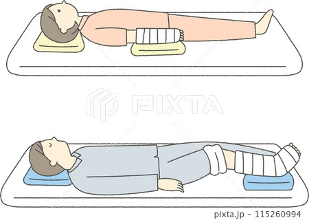 ベッドに横になる骨折患者 115260994