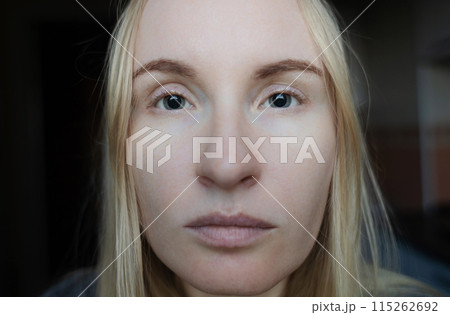 Examination of the fundus and dilated pupils. A doctor performs an ophthalmoscopy on a woman who has mydriasis and accommodation spasm. Poor vision and paralysis of the eye muscles 115262692