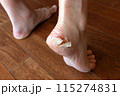 Close up of dry feet. Peeling and cracked foot. The skin peels off the heel. Fungal infection or athletes foot, dermatitis, psoriasis, sweaty feet or dehydration. 115274831