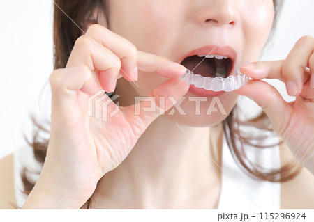 マウスピースをはめる女性　矯正イメージ 115296924