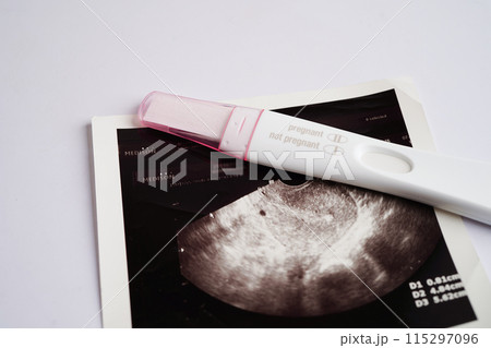 Pregnancy test with ultrasound scan photo of fetus, maternity, childbirth, birth control. Pregnancy test with ultrasound scan photo of fetus, maternity, childbirth, birth control. 115297096