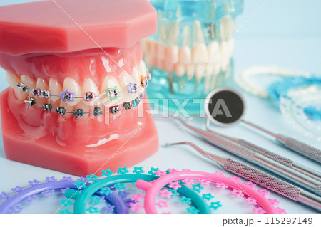 Orthodontic ligatures rings and ties, elastic rubber bands on orthodontic braces, model for dentist studying about dentistry. Orthodontic ligatures rings and ties, elastic rubber bands on orthodontic braces, model for dentist studying about dentistry. 115297149