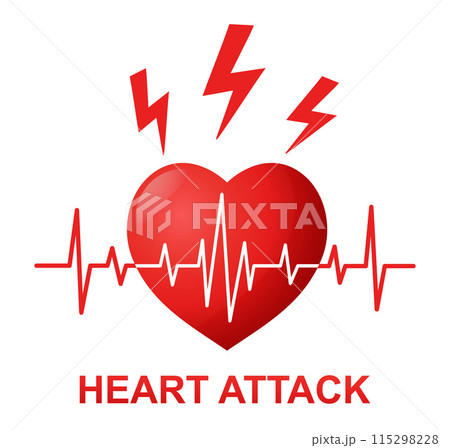 Heart attack, heartbeat pulse rhythm, heartache, cardiac failure stroke, cardiovascular disease medical treatment icon. ECG cardiogram. Cardio hypertension. Health care. Stress, love problem. Vector 115298228