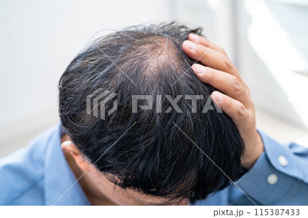 Bald in the middle head and begin no loss hair glabrous of mature Asian business smart active office man. 115387433
