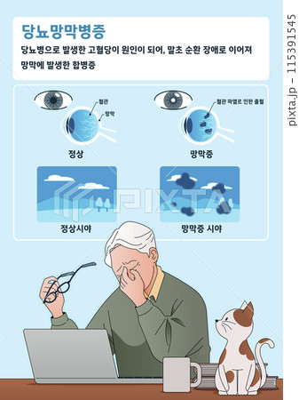 Diabetic retinopathy Explanation and Symptoms 115391545