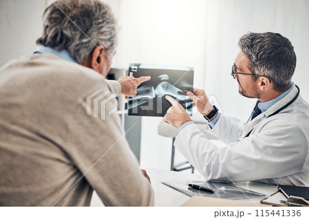 Advice, man and doctor in office with xray, results and health insurance consultation at arthritis clinic. Diagnosis, senior patient and medical professional at desk with support, scan and healthcare 115441336