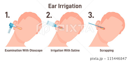 ENT doctor irrigate ears. Doctor checking ear canals, removing earwax with saline solution. Patient at medical checkup at otolaryngologist appointment. Flat vector illustration 115446847
