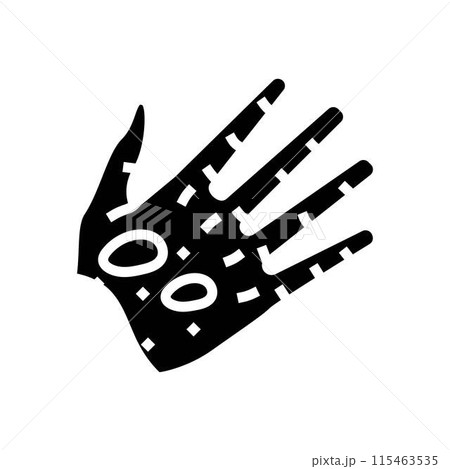 epidermolysis bullosa disease glyph icon vector illustration 115463535