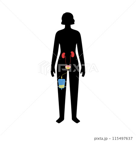 Urinary drainage bag Urinary drainage bag 115497637